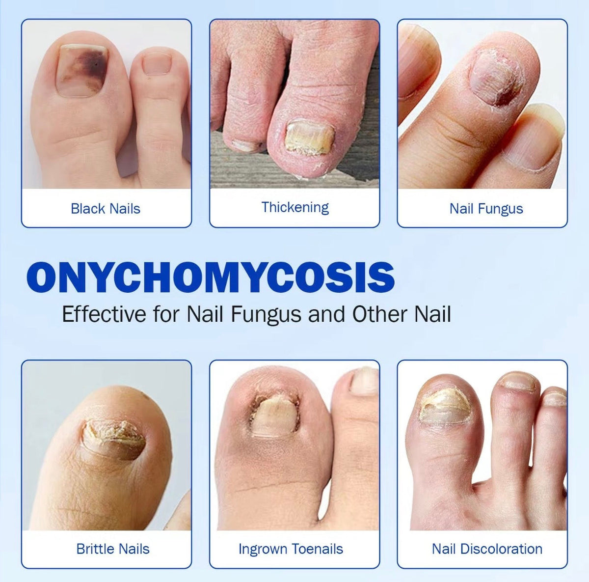 FungaFix Nail Patches 4