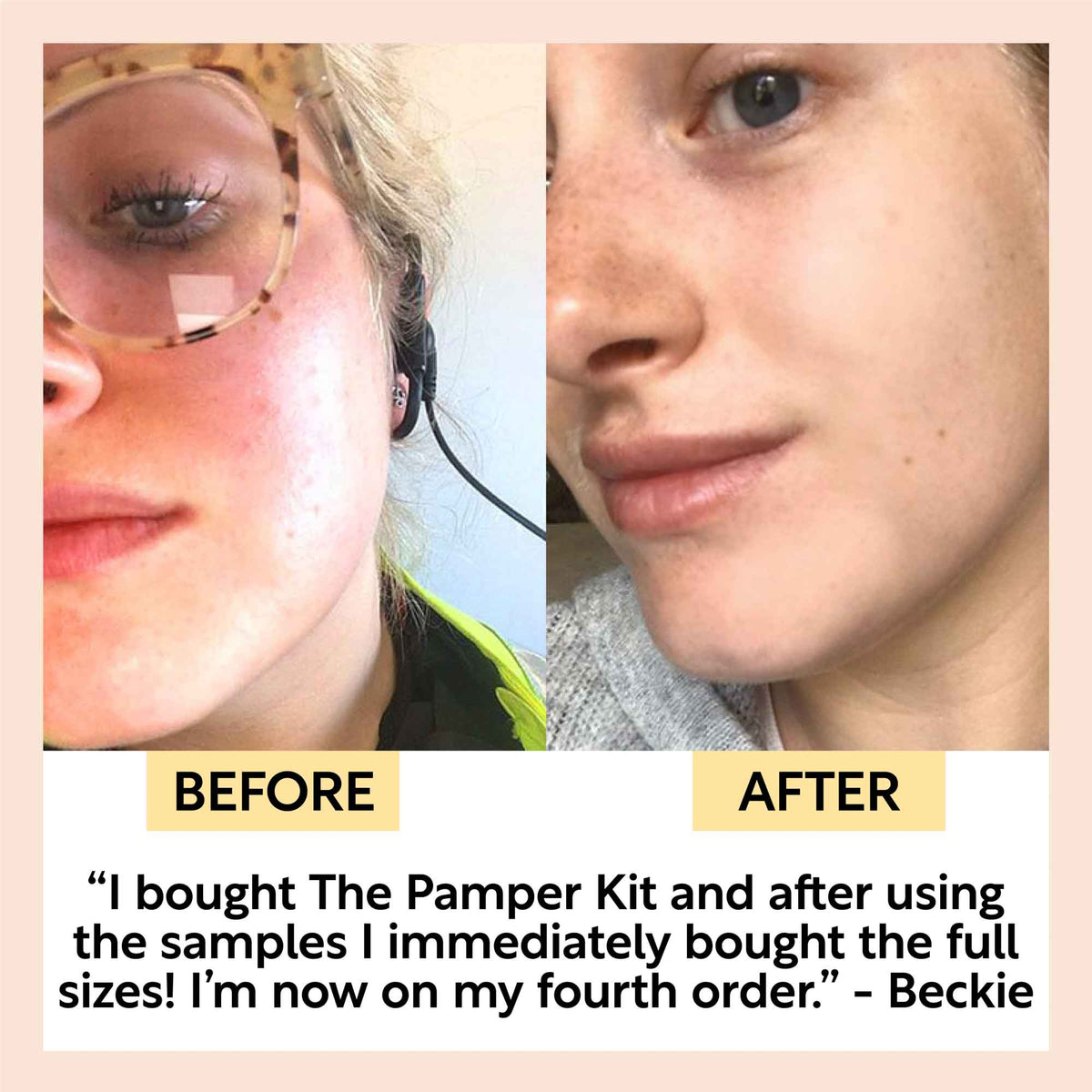 The Pamper Kit 7