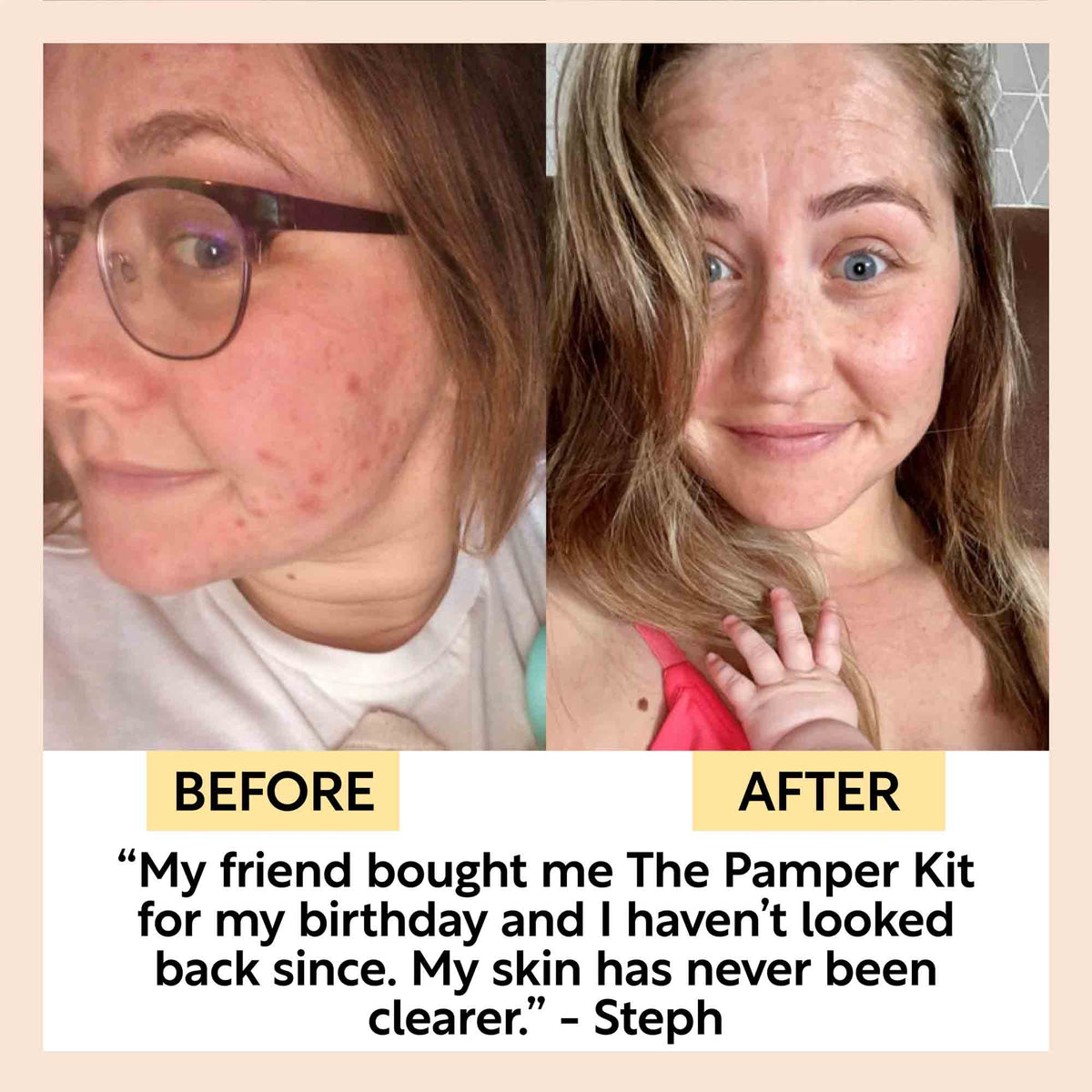 The Pamper Kit 8