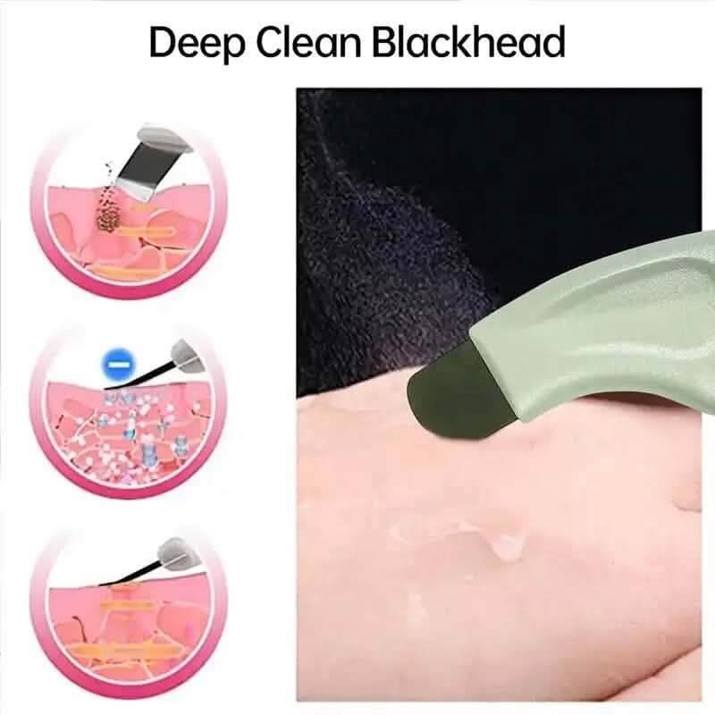 Blackhead Remover Tool Extractor 5