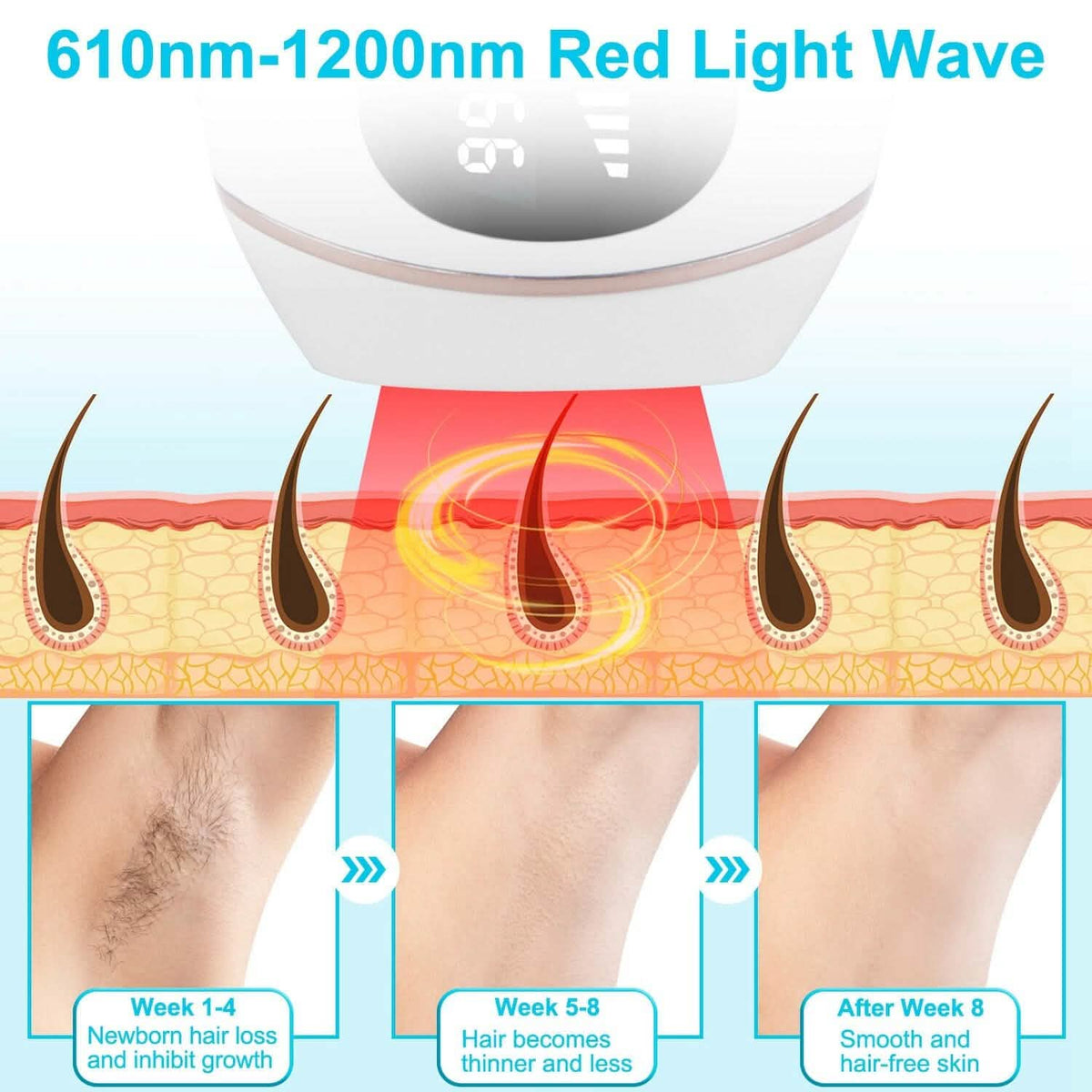 Laser Hair Removal Ice Cooling Permanent IPL 10